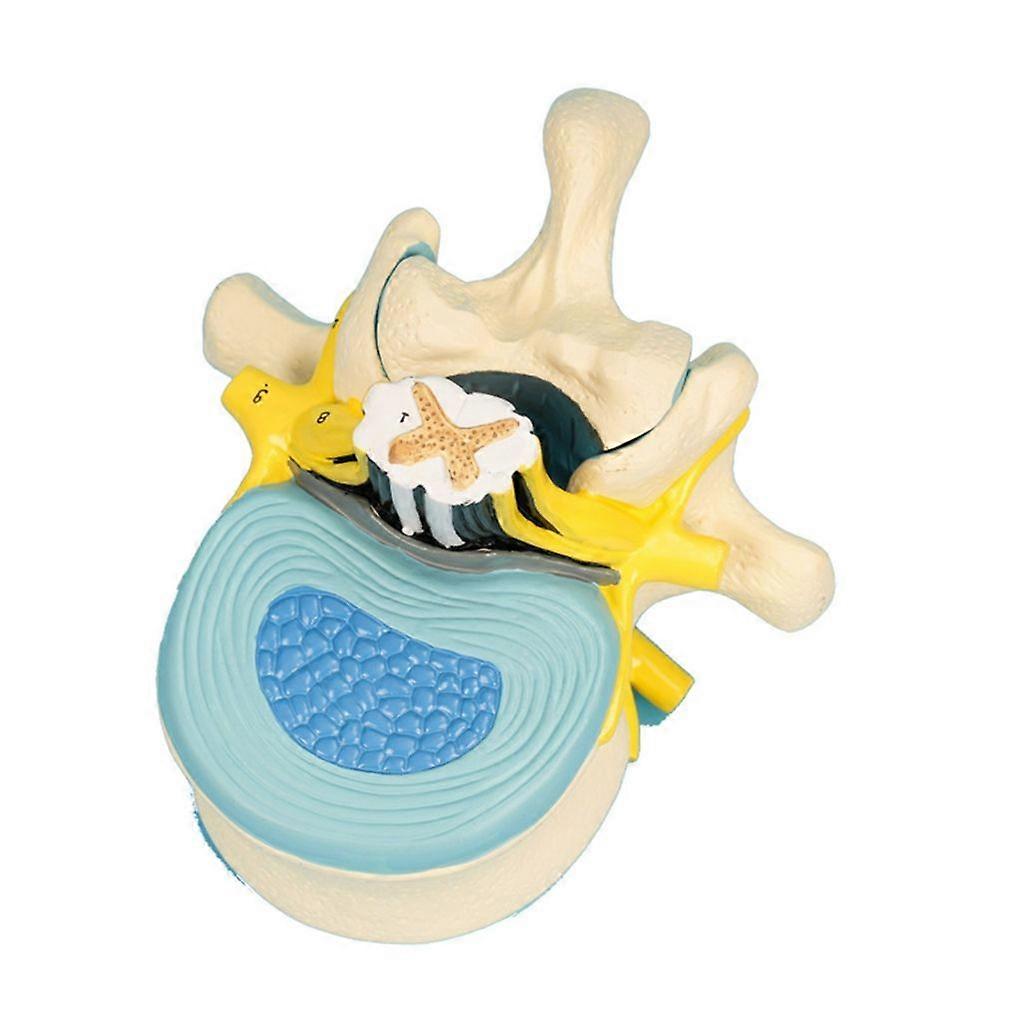 Lumbar Vertebra Anatomy Model for Educational Training Aids