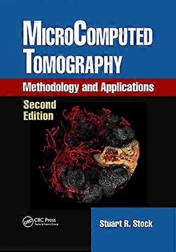 MicroComputed Tomography: Methodology and Applications, Second Edition