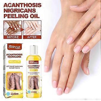 Peeling Olie voor de donkere huid, Gele Peeling Olie Met Salicyl natriumhyaluronaat, Sterke Peeling Olie Extra Sterkte, Exfoliërende Peeling Oplossing Voor B