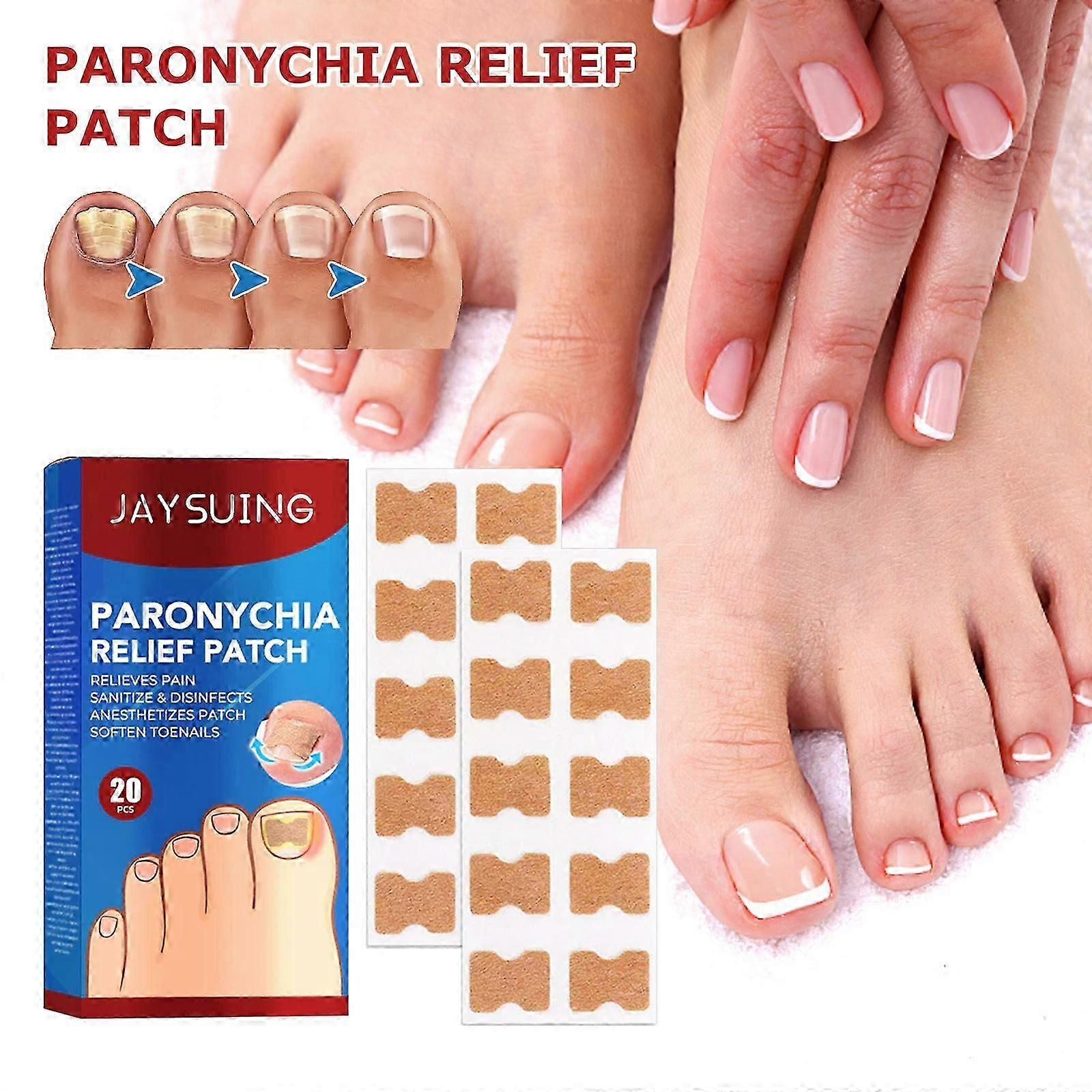 Jaysuing nagelspår vård lapp reparation förtjockning typ grå spik mjuk nagelkorrigering spik spår lapp