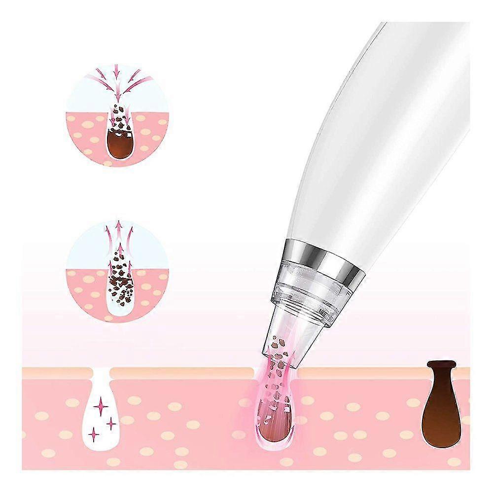 Blackhead Remover Pore Cleaner Multifunction Blackhead Suction Heating Mode 3 Light Modes