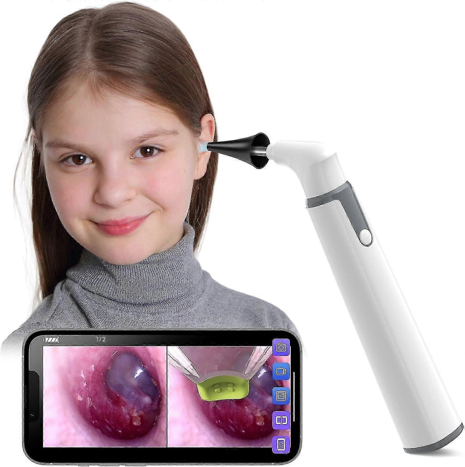 Wireless Otoscope Ear Camera With Dual View, 3.9mm 720phd Wifi Ear Scope With 6 Led Lights For Kids And Adults, For Android And Iphone