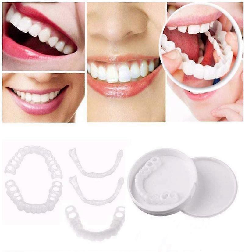 Perfect Smile Veneers Comfort Fit, Flex Denture Paste Braces