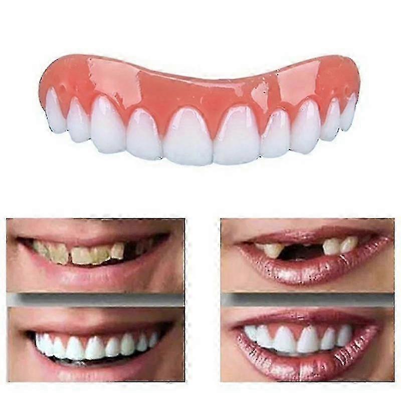 Flex denture for teeth enhancement - Snap On Smile comfortable veneers