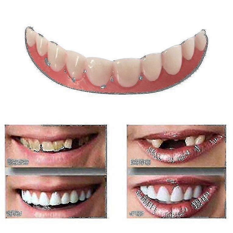 Άμεσο Χαμόγελο Άνεση Εφαρμογή Flex Λεύκανση Δοντιών Οδοντοστοιχία Επικόλληση Κάλυμμα H