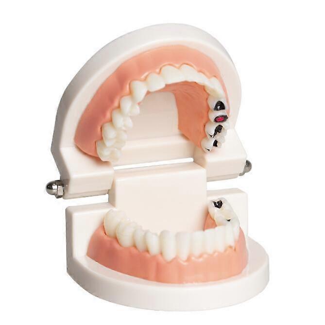 Teeth Model,For Tooth Teach Practice Model Teaching
