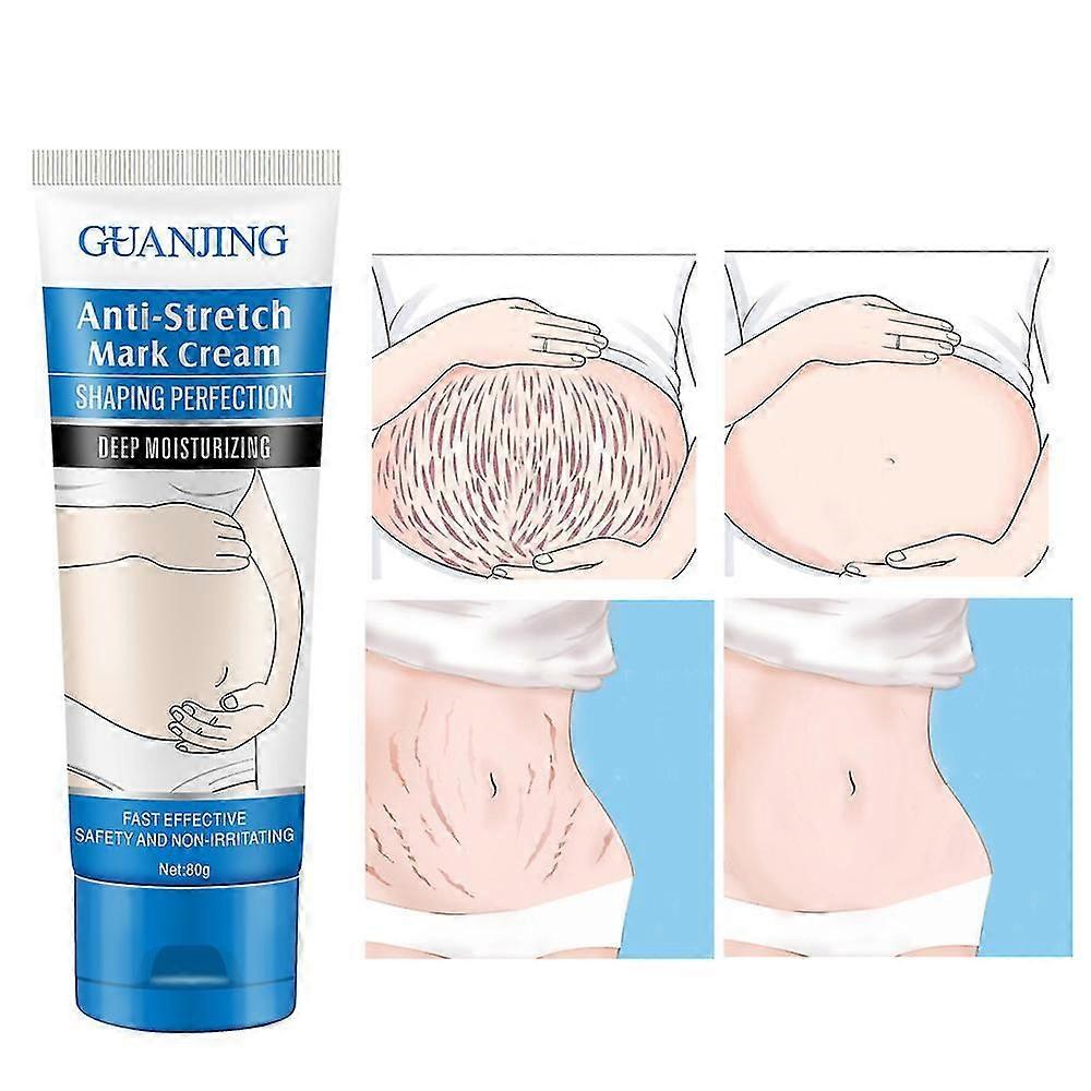 Anti Stretch Mark Body Cream 80g Maintain More Elasticity Reduce Redness & Rough Texture Body