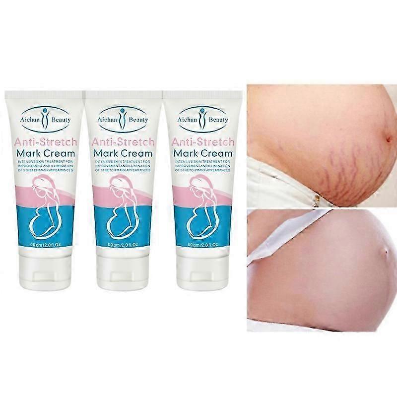 3xストレッチマーククリームカタツムリエキスアンチ細い線を引き締めるマタニティスラックライン妊婦クリームのスキンクリームを