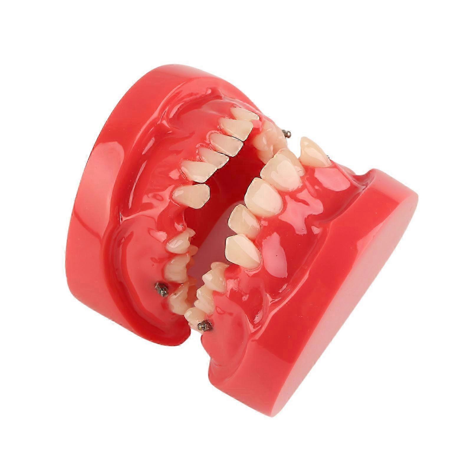 Dental Typodont Teaching Tool 24 Teeth Model for Orthodontics Study and Demonstration