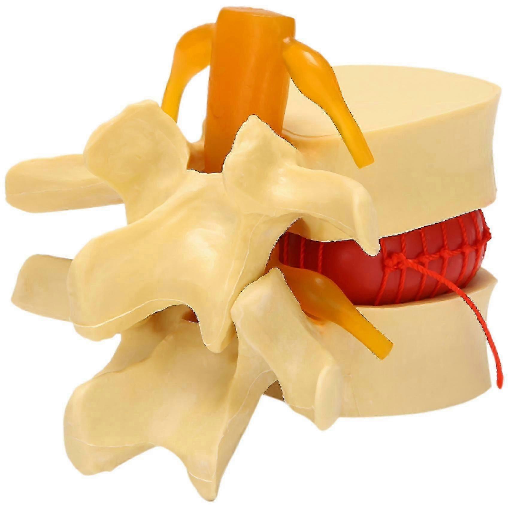 Lendenwirbel Modell Anatomisch Lendenwirbel Bandscheibenvorfall Anatomie Lehrwerkzeug Lendenwirbel Mod - JA