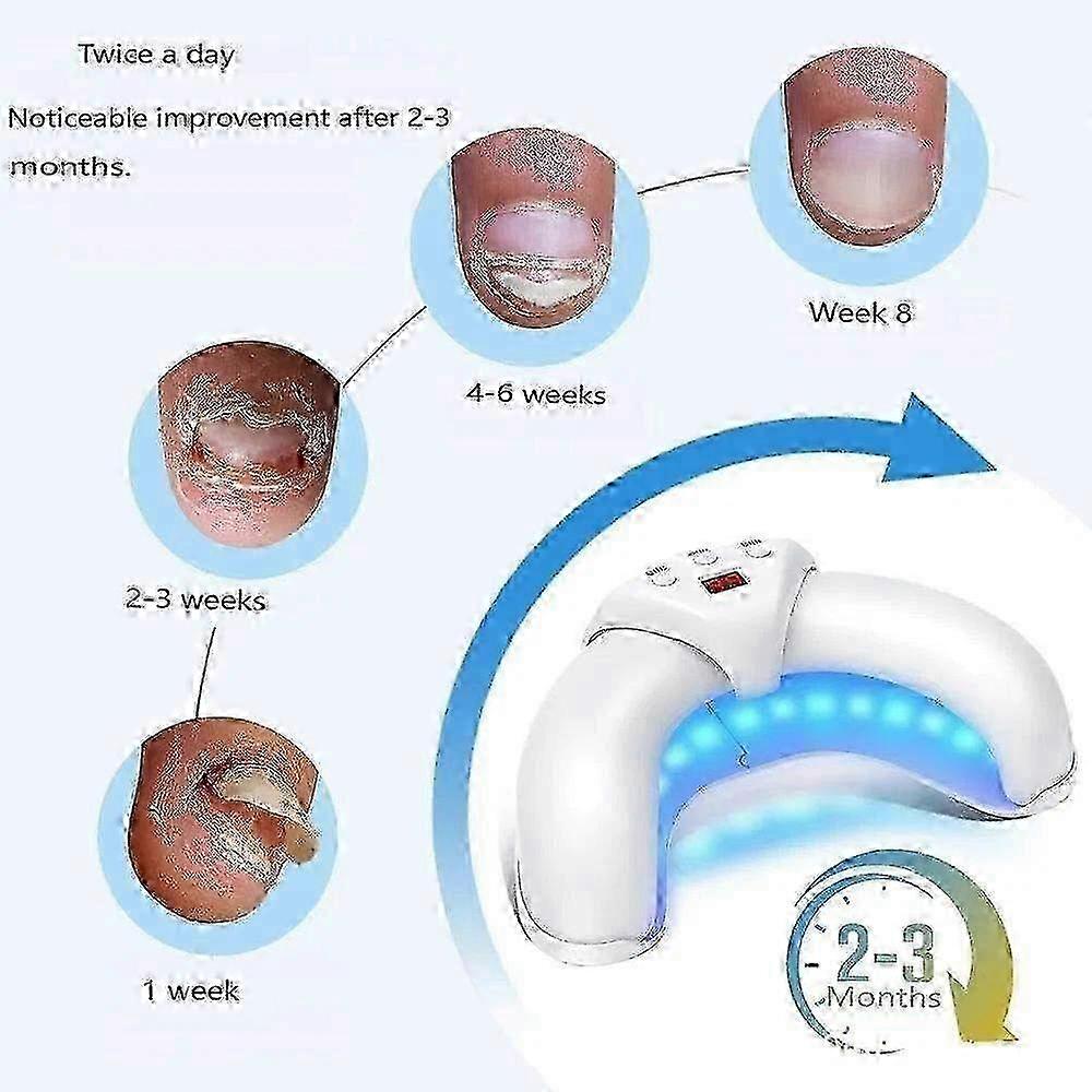 USB-Powered Nail Laser Therapy Device