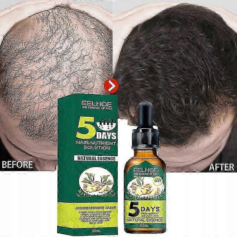 ファストヘアグロースプロダクツ5日ジンジャーヘアグロー