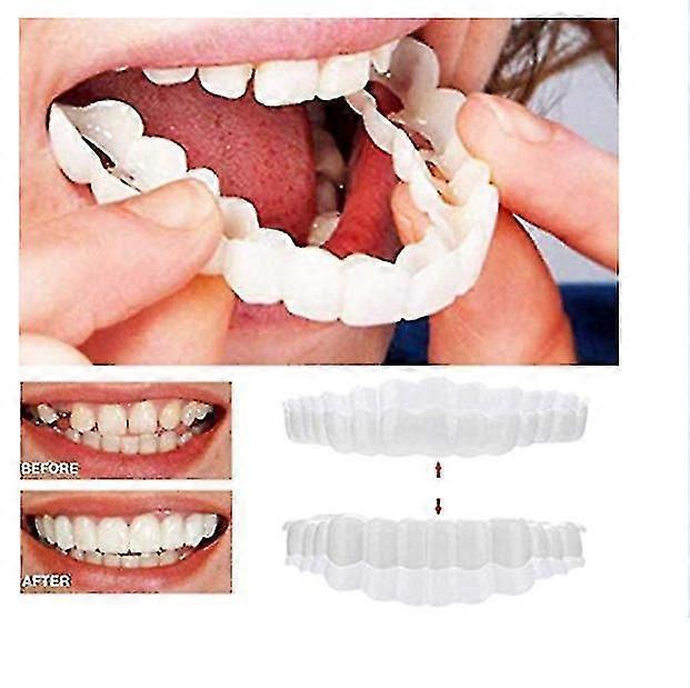 Οδοντιατρικές όψεις με κουμπωτό σύστημα για προσωρινή κάλυψη δοντιών - UK Cosmetic Smile Solution