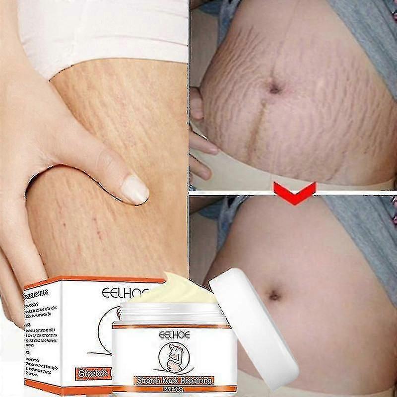 2x علامات التمدد إزالة كريم نمو الدهون خطوط الأمومة ندبات إصلاح حب الشباب زيادة مرونة الجلد مكافحة التجاعيد ثابتة العناية بالجسم