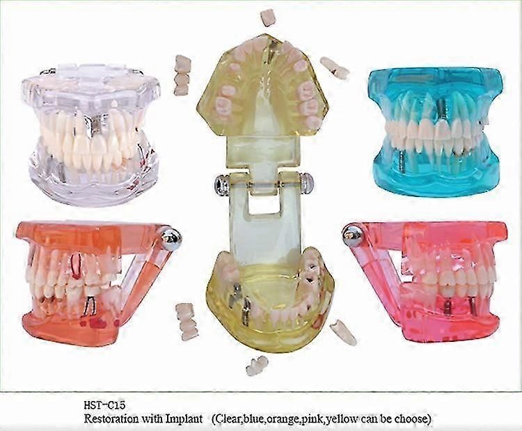 Dental Teaching Model - Single Piece Implant & Bridge Demonstration Tooth With Brackets 11 thumbnail image