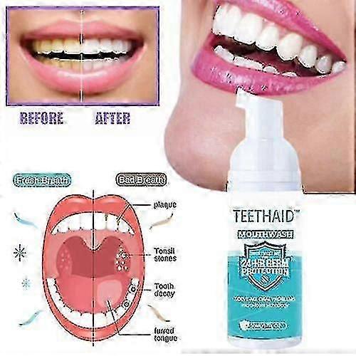 3 Bottles 100Ml Teethaid Mouthwash Calculus Removal Teeth Whitening Healing Mouth Ulcers Eliminating Bad Breath Preventing And Healing Caries Tooth Re