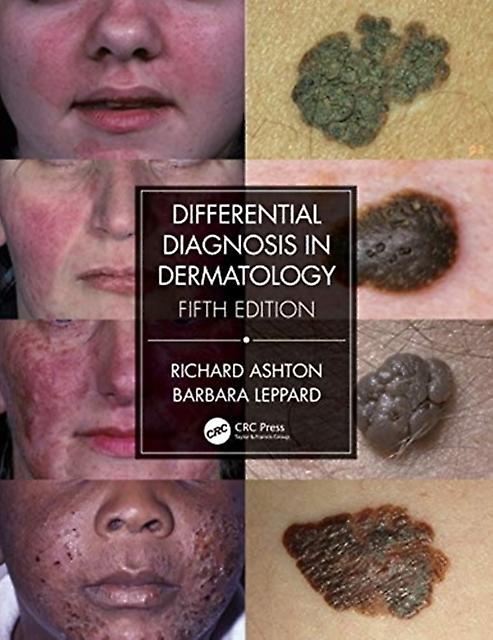 Differential Diagnosis In Dermatology by Barbara Leppard Paperback