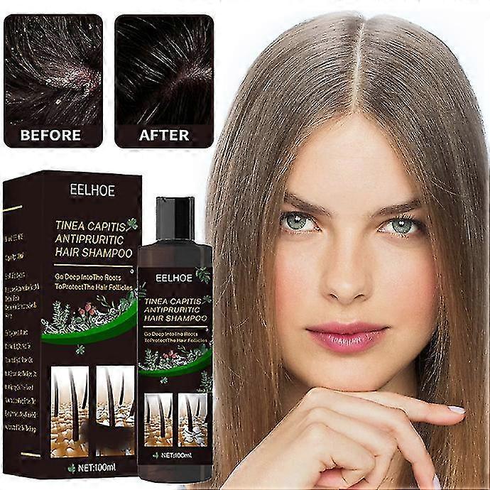 Remove Tinea Capitis Shampoo Dandruff Itching Control Refreshing Shampoo