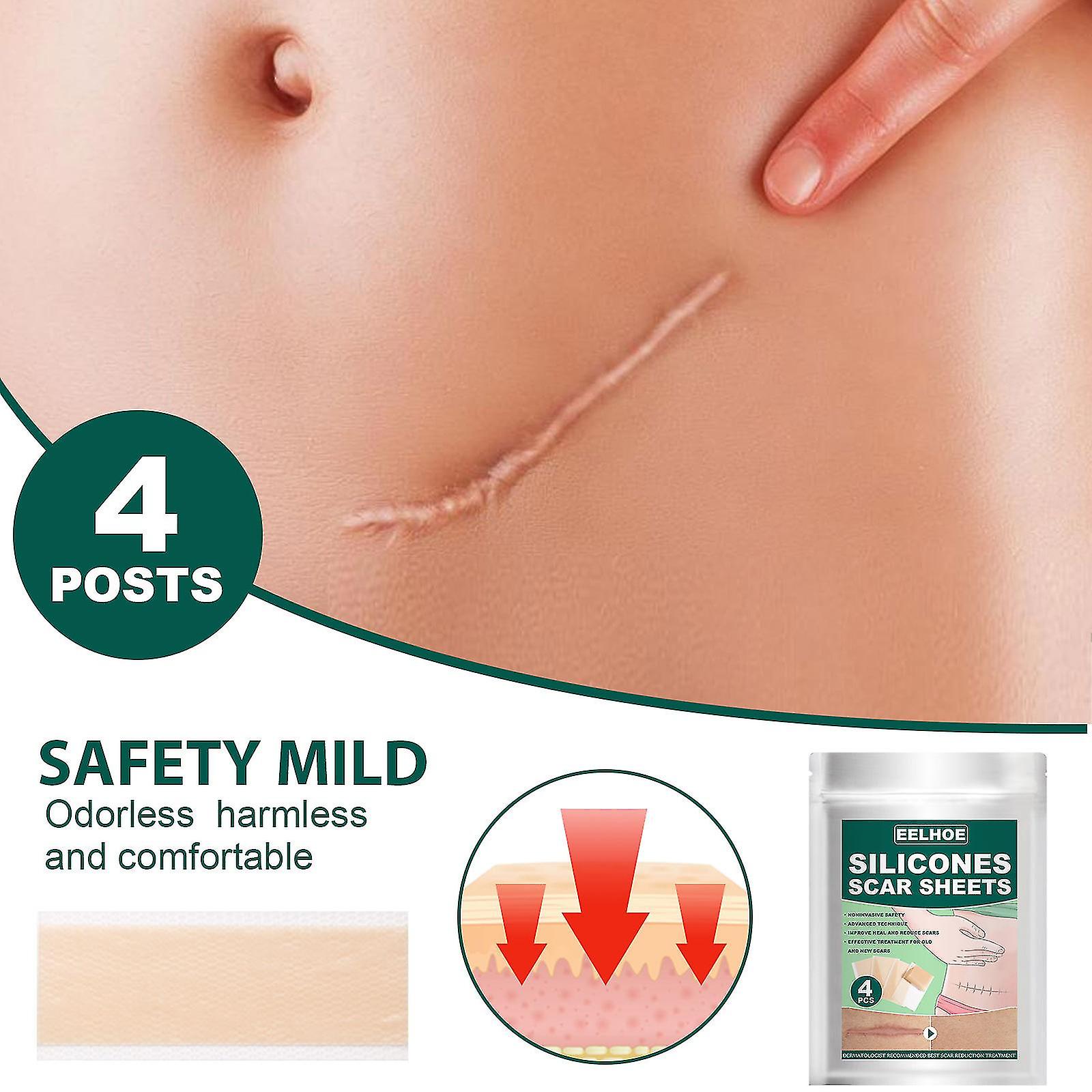 Gel cicatriciel en silicone de qualité médicale Tunisia Gel cicatriciel en silicone de qualité médicale Tunisia
