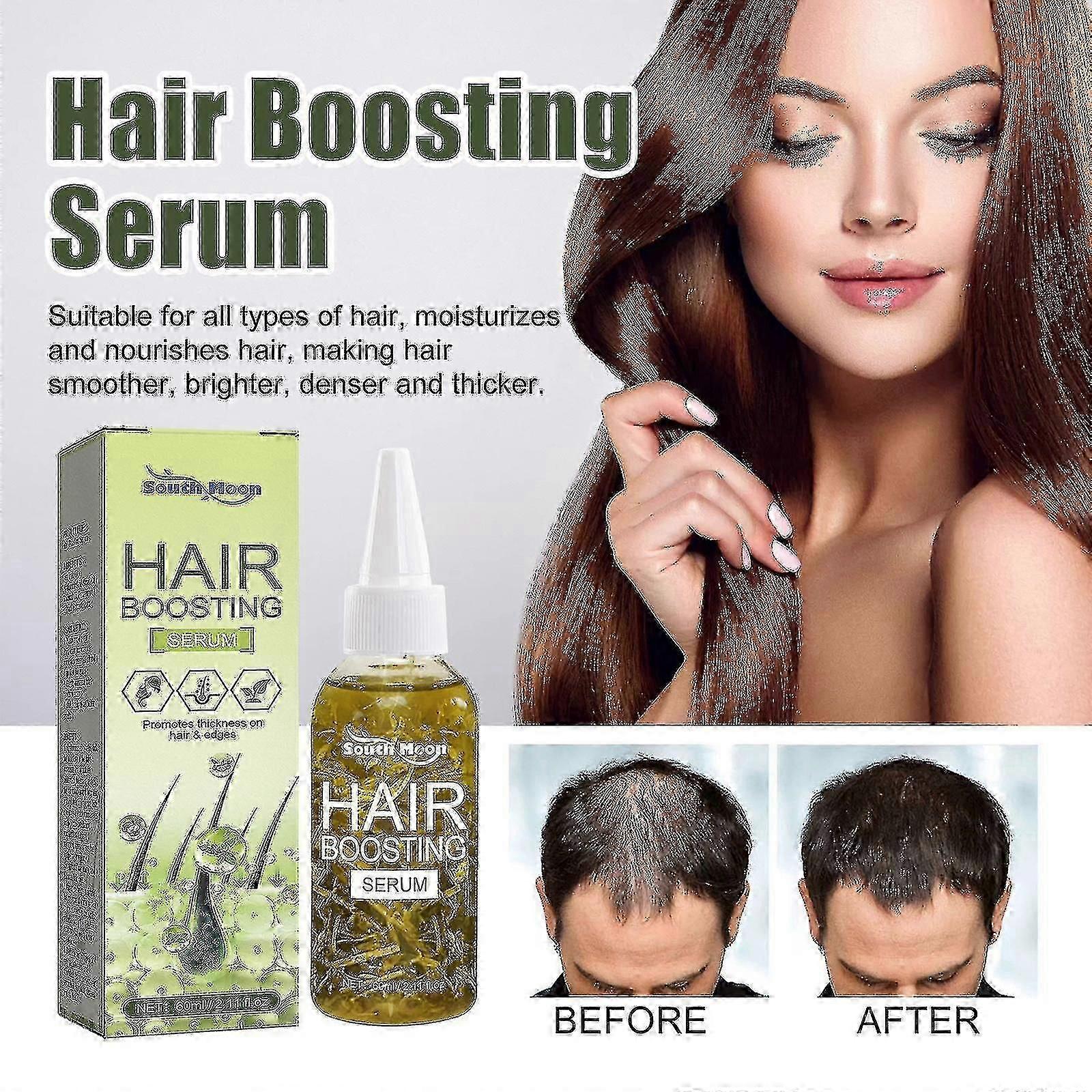 Behandlingar mot håravfall Behandling av håravfall