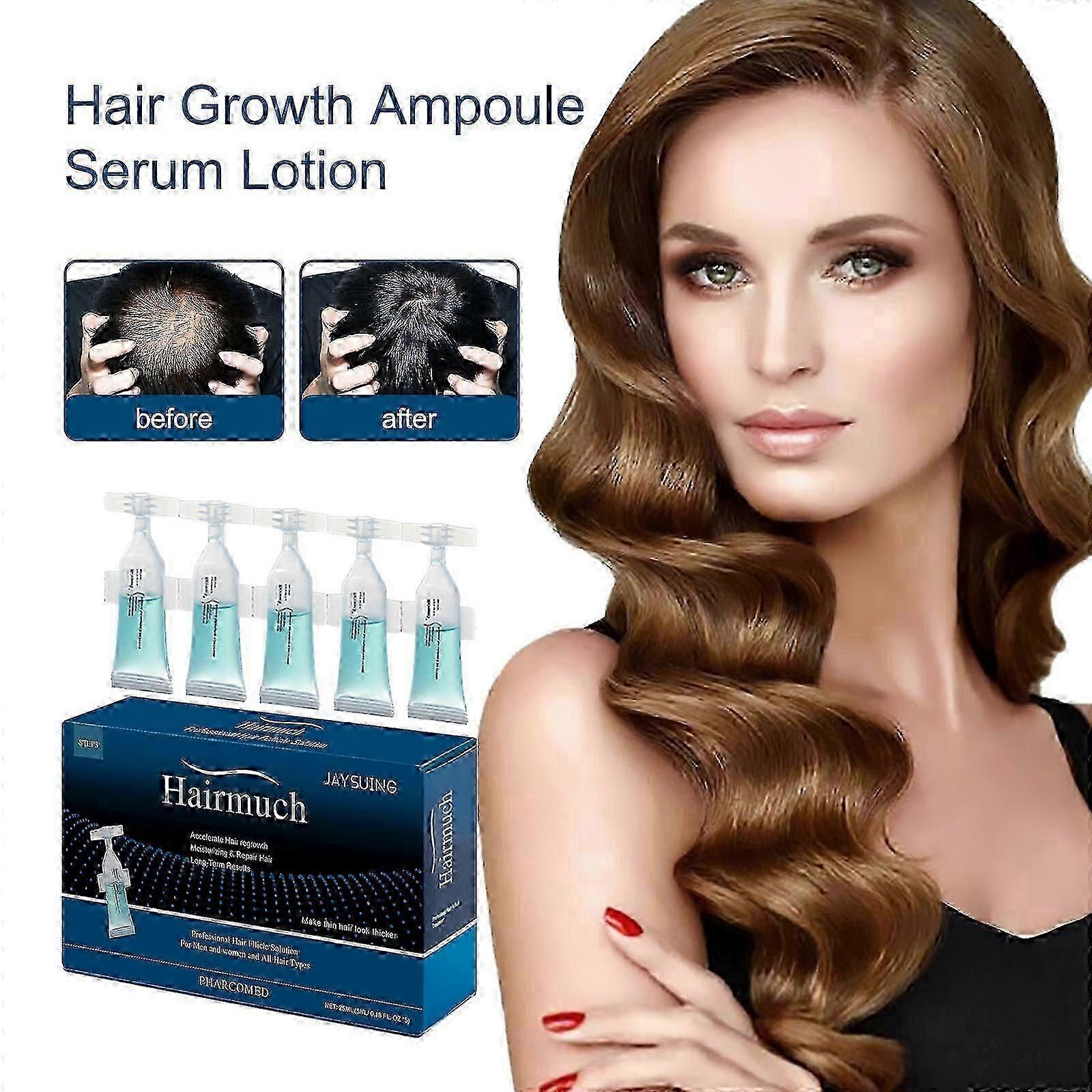 Forte Hair Lotion, Hair Growth Ampoule Serum Lotion, Hair Growth Serum With Androgen and DHT Blockers For Thinning Hair Promotes Stronger Thicker Hair