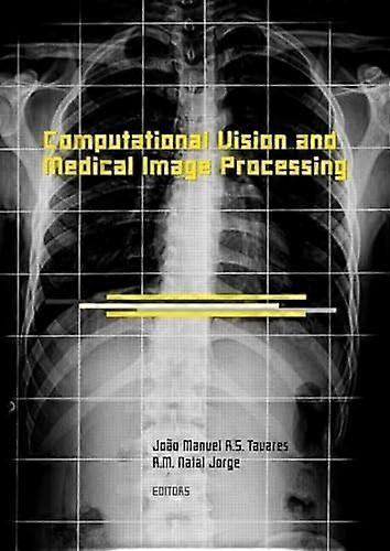 Computational Vision and Medical Image Processing: VipIMAGE 2007