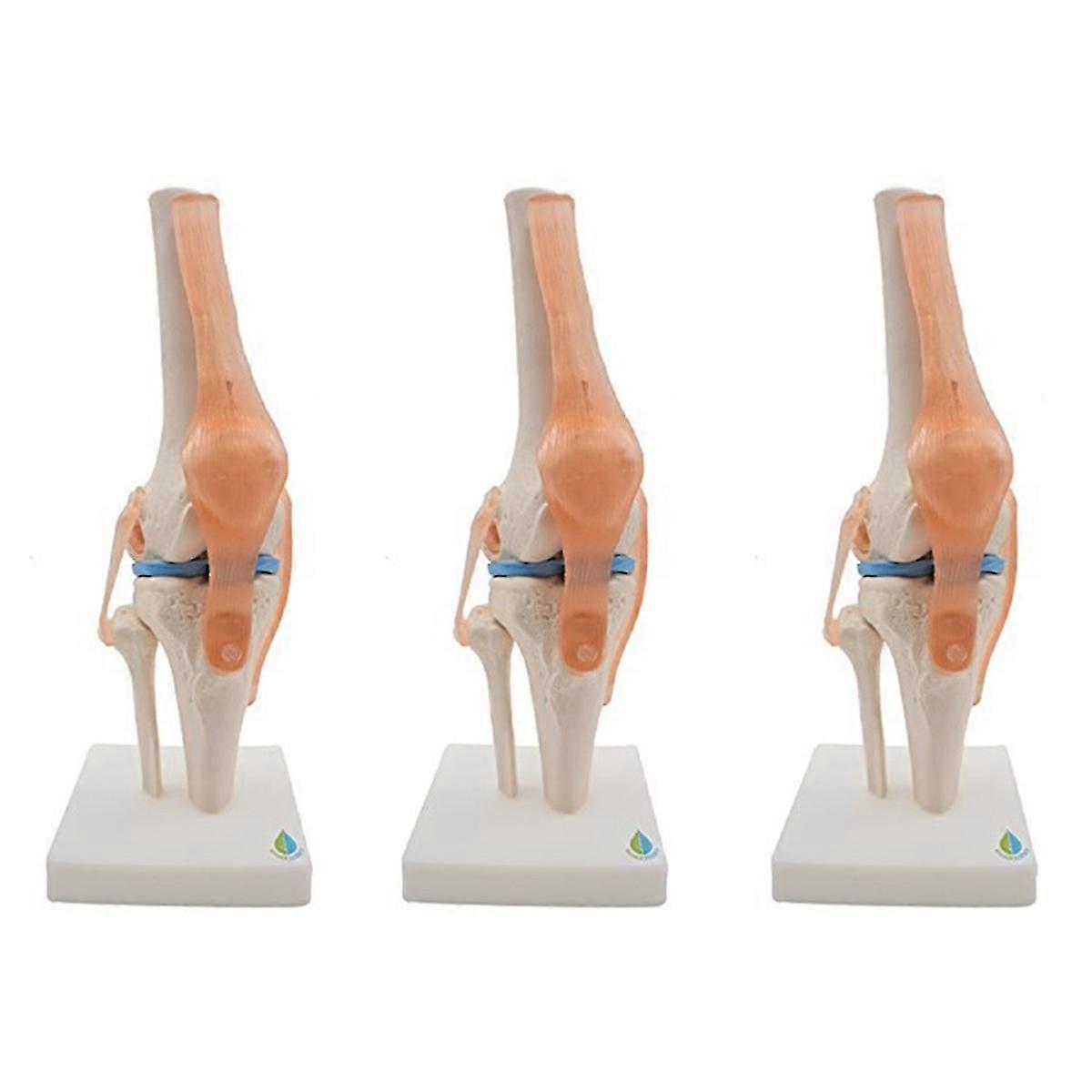 3X Anatomical Knee Joint with Ligaments Model, Life Size