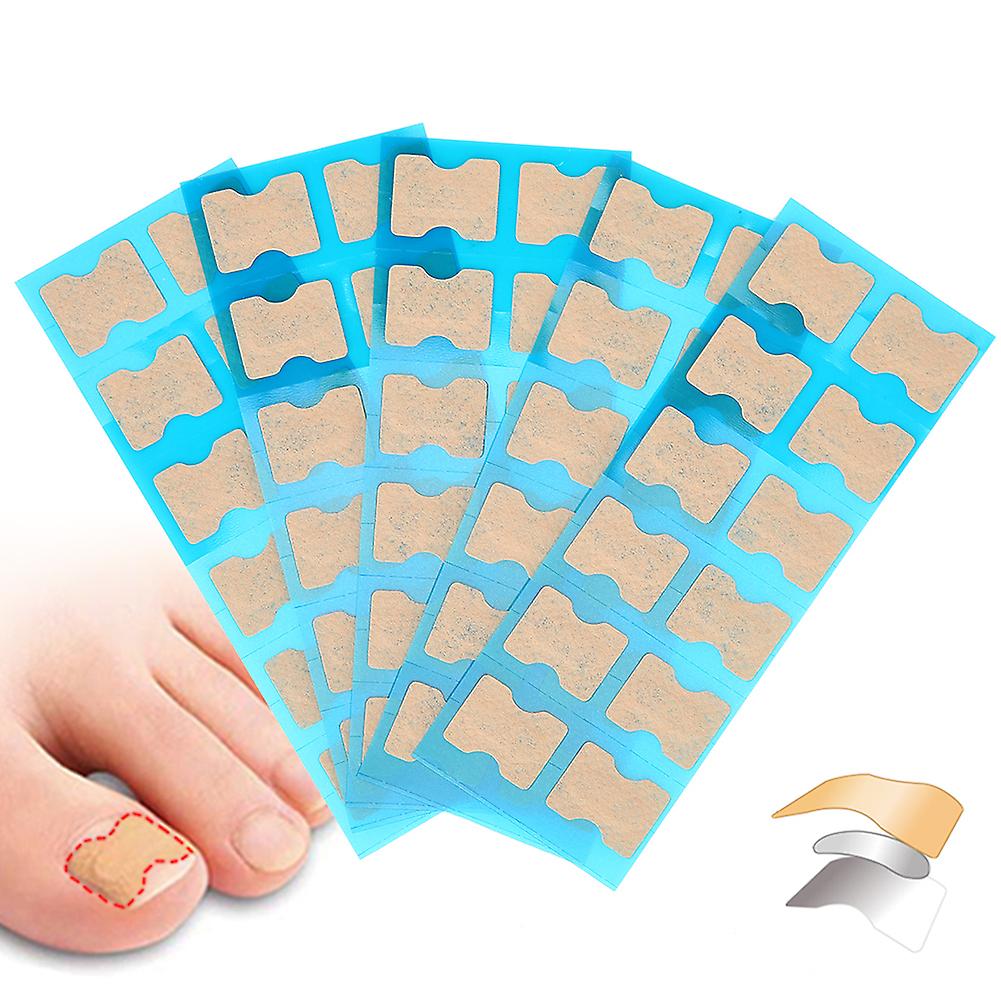 60Pcs Ingrown Toenail Corrector Patch Foot Care Pedicure Nail Treatment Tool