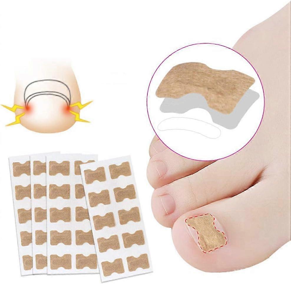 Ingrown Toenail Correction Patch 100 Pcs Stickers with Double Sided Adhesive Corrector Pedicure Tools