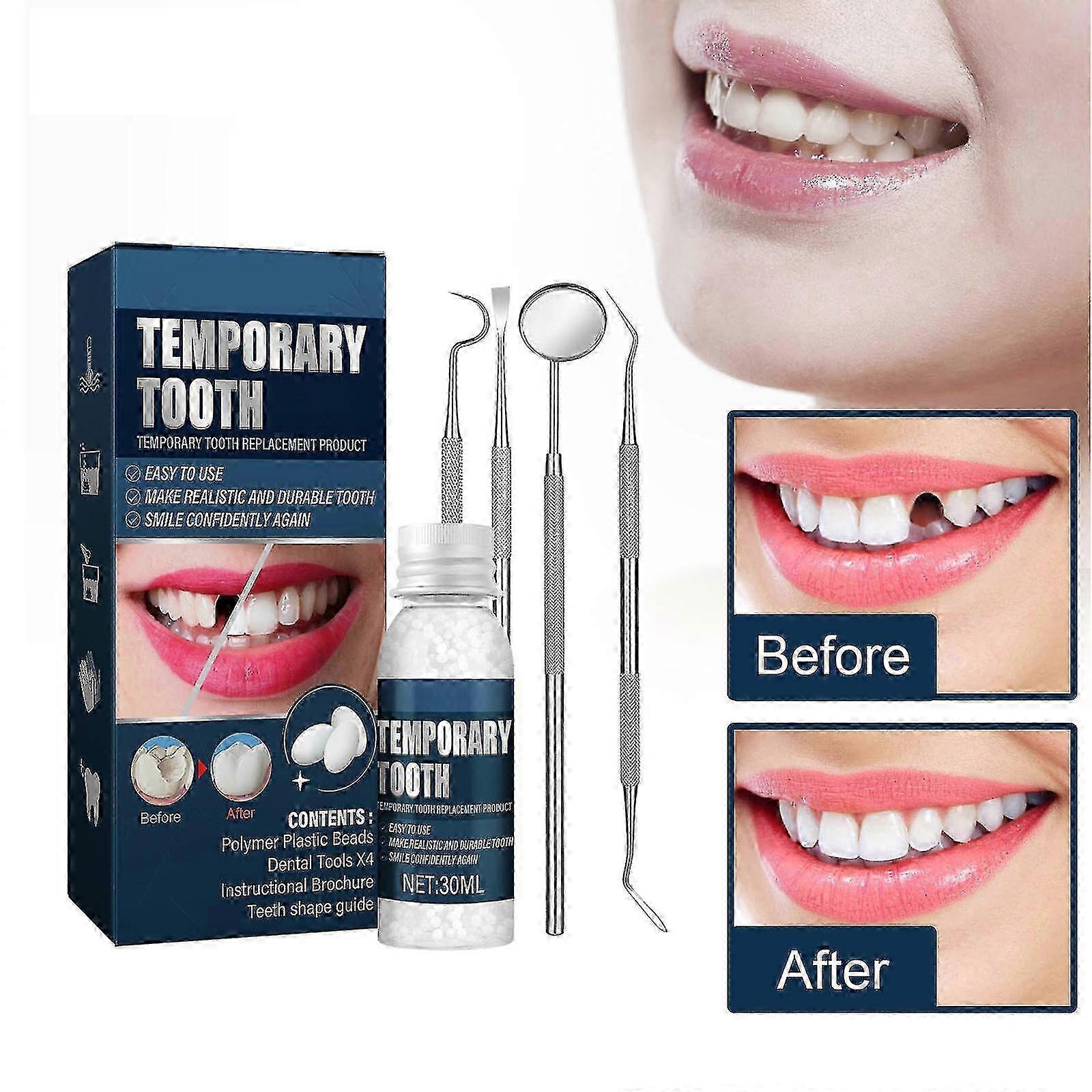Tooth Repair Kit, Temporary Teeth Filling Repair Kit, Fixing The Missing And Broken Tooth Replacements Restore Your Smile