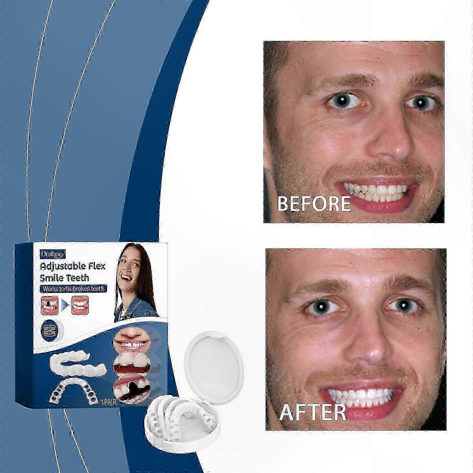 Instant Smile Alignment - Adjustable Silicone Dentures for Gaps & Misalignment