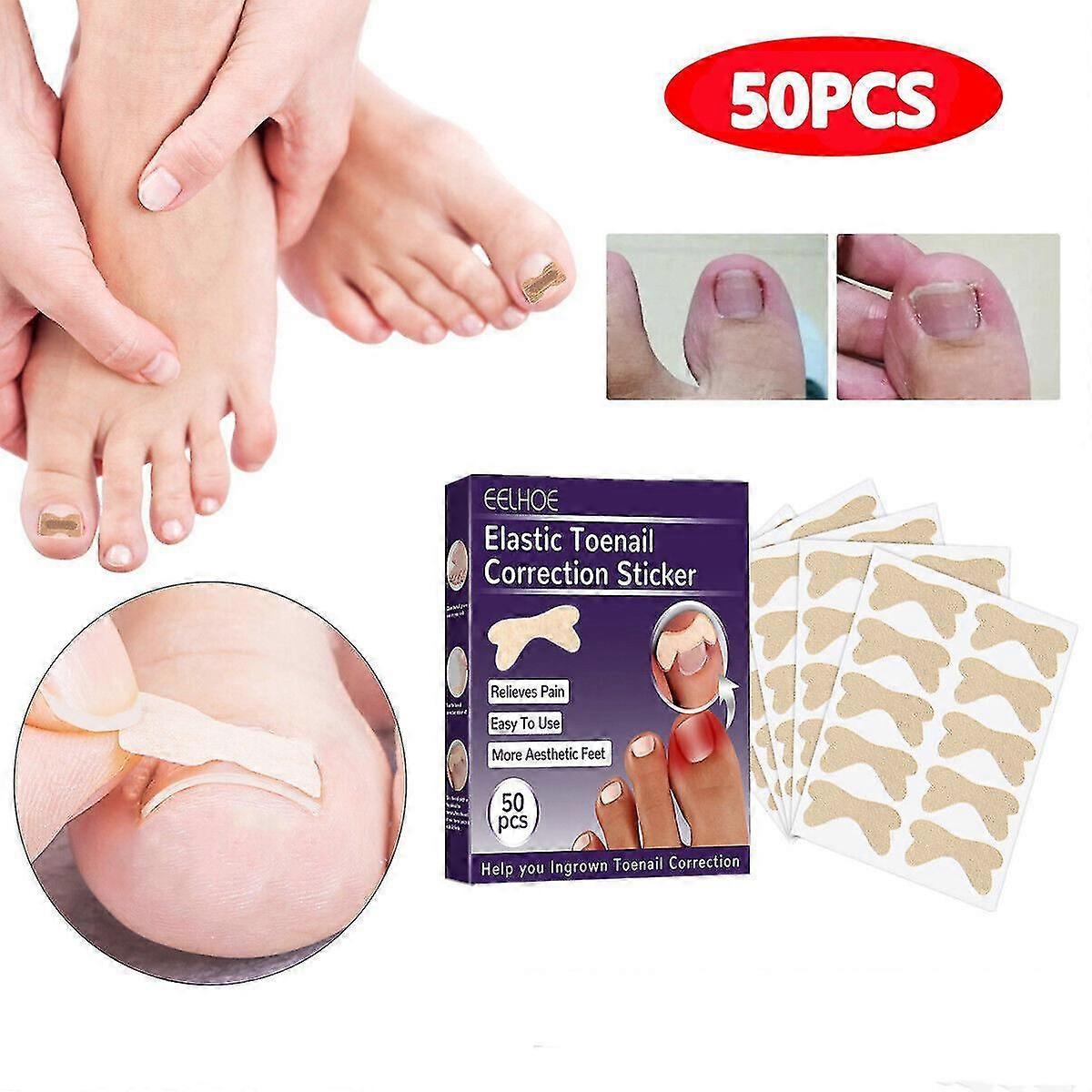 50 Pcs Toenail Corrector Pedicure Patch Ingrown Toe Nail Correction Sticker