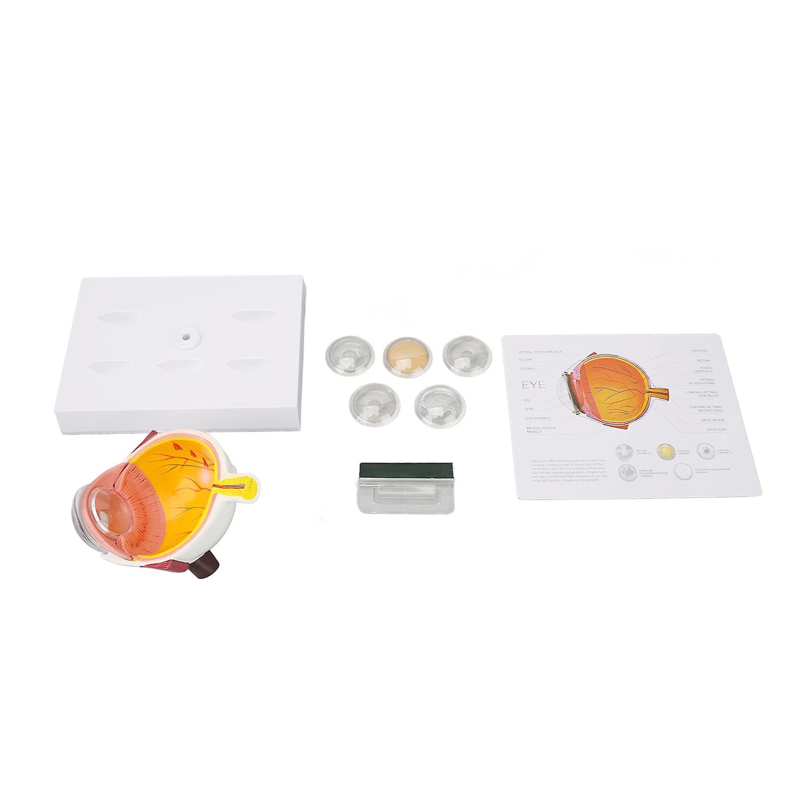Eye Model Educational Shows Cornea Iris Human Eyeball Model Teaching Display Internal External Structure Enlarged