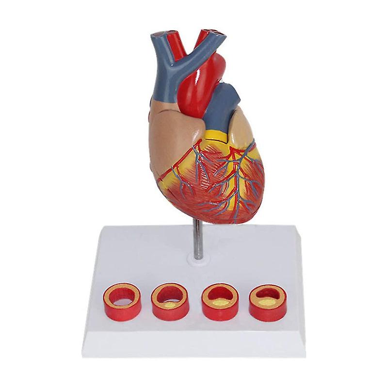 Human Heart Anatomy Model With 4 Stage Thrombus Medical Science Teaching Resources Drop Shipping