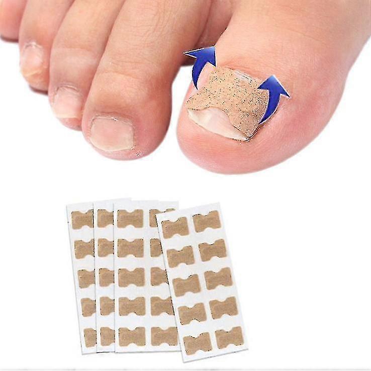 100pcs Toenail Correction Patch Glue Free Pedicure Tools Corrector Toe Nail Ingrown Patch Tw
