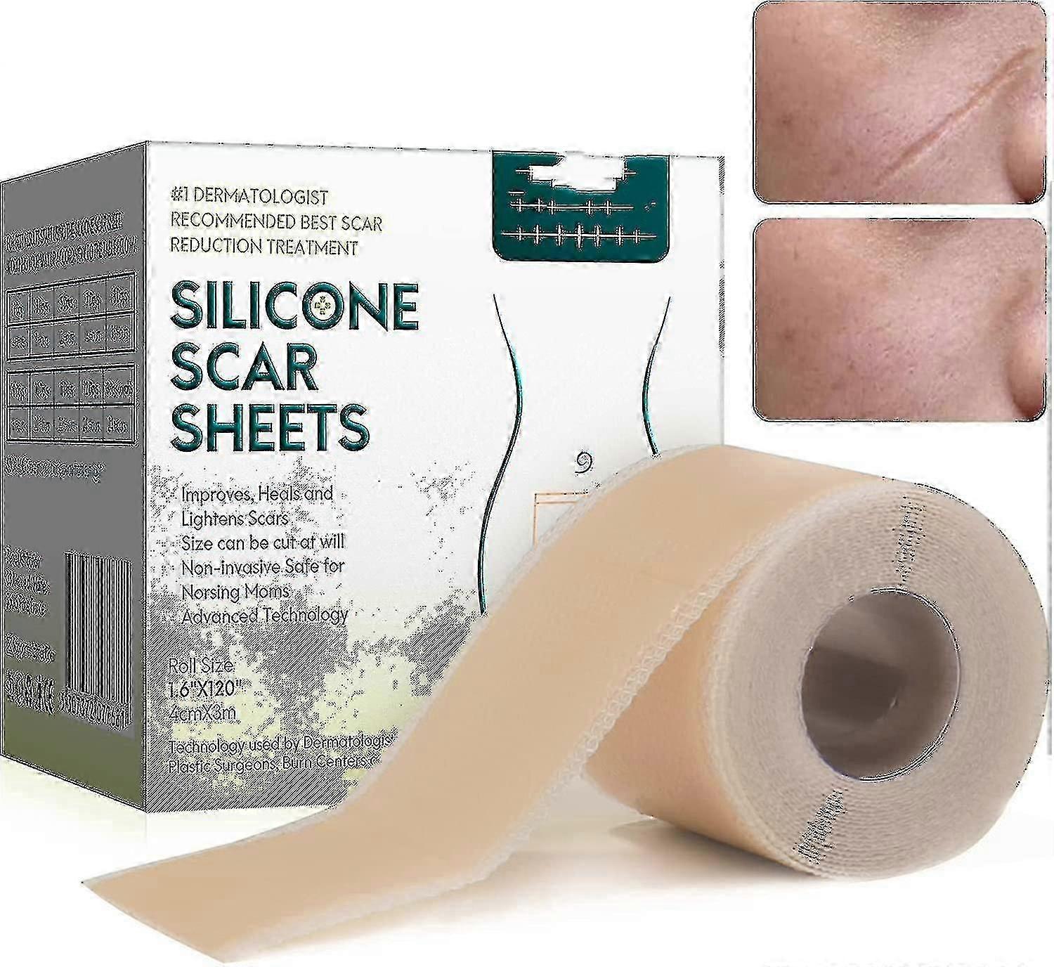 Silicone Plasters For Scars, Silicone Scar Films For Surgeries, Caesarean Section, Keloids, Burns,silicone Scar Tape-4cm*3m