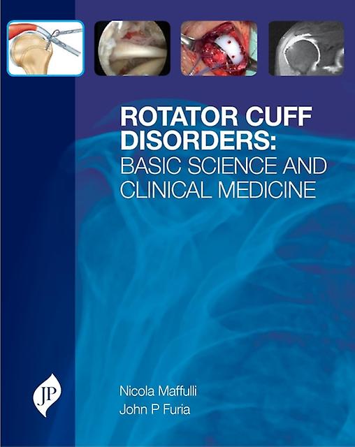 Rotator Cuff Disorders by John P Furia Paperback Book