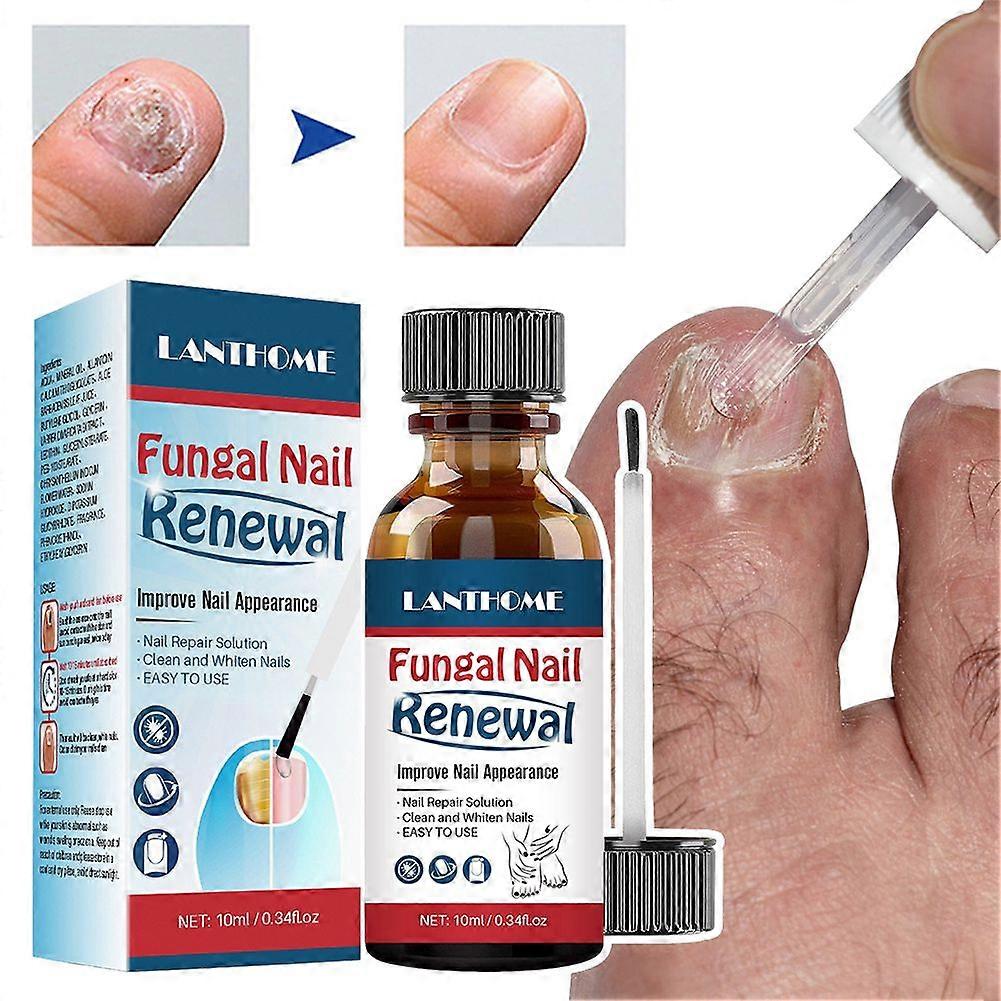 ネイルリペアソリューションクイック吸収ネイル強化リキッド男性女性用