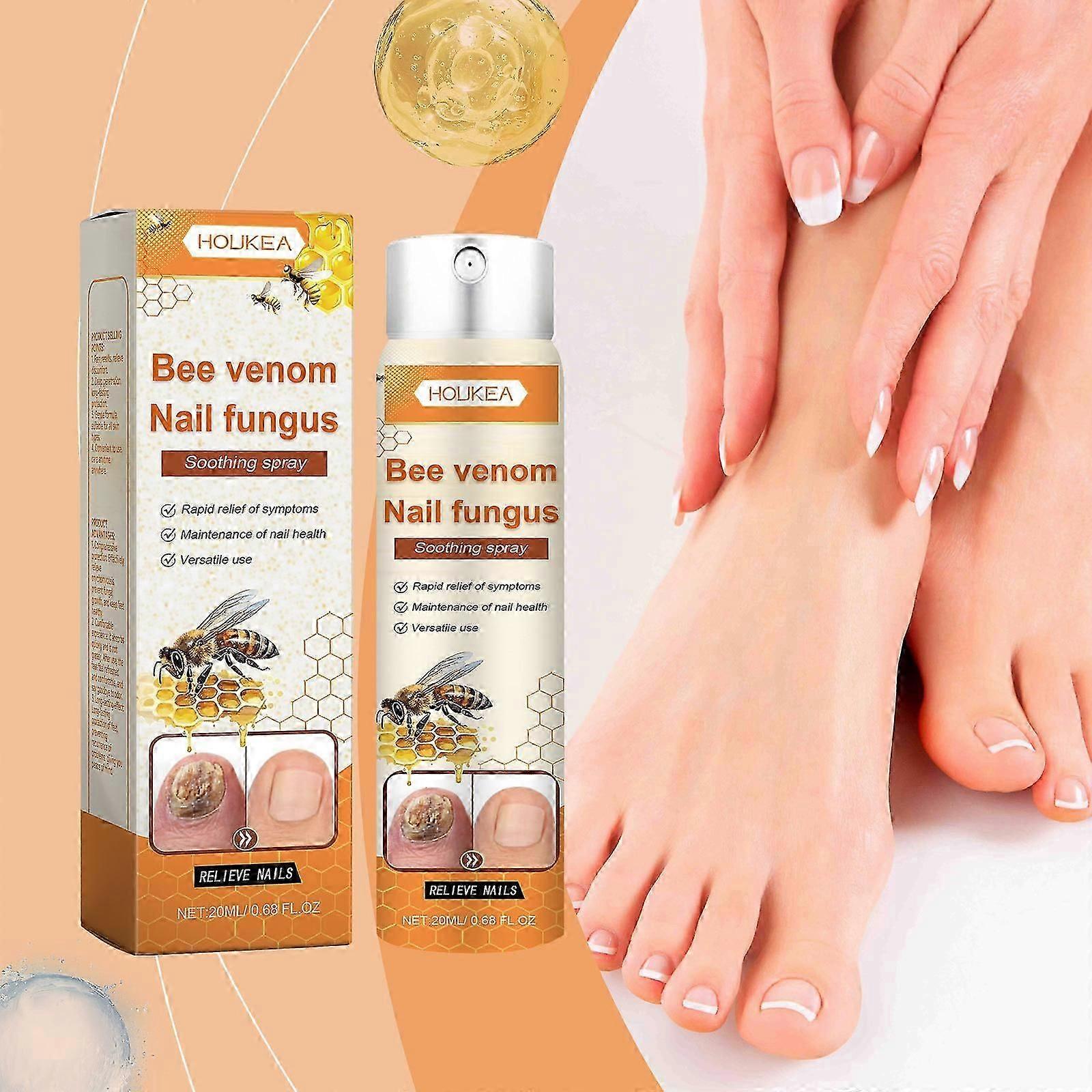 Solução para tratamento de unhas com veneno de abelha, tratamento para fungos nas unhas com veneno de abelha, solução extra forte para reparo de unhas, spray para tratamento de fungos nas unhas