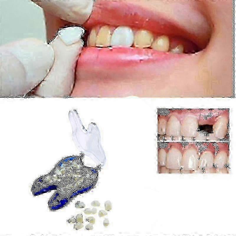 temporary dentures