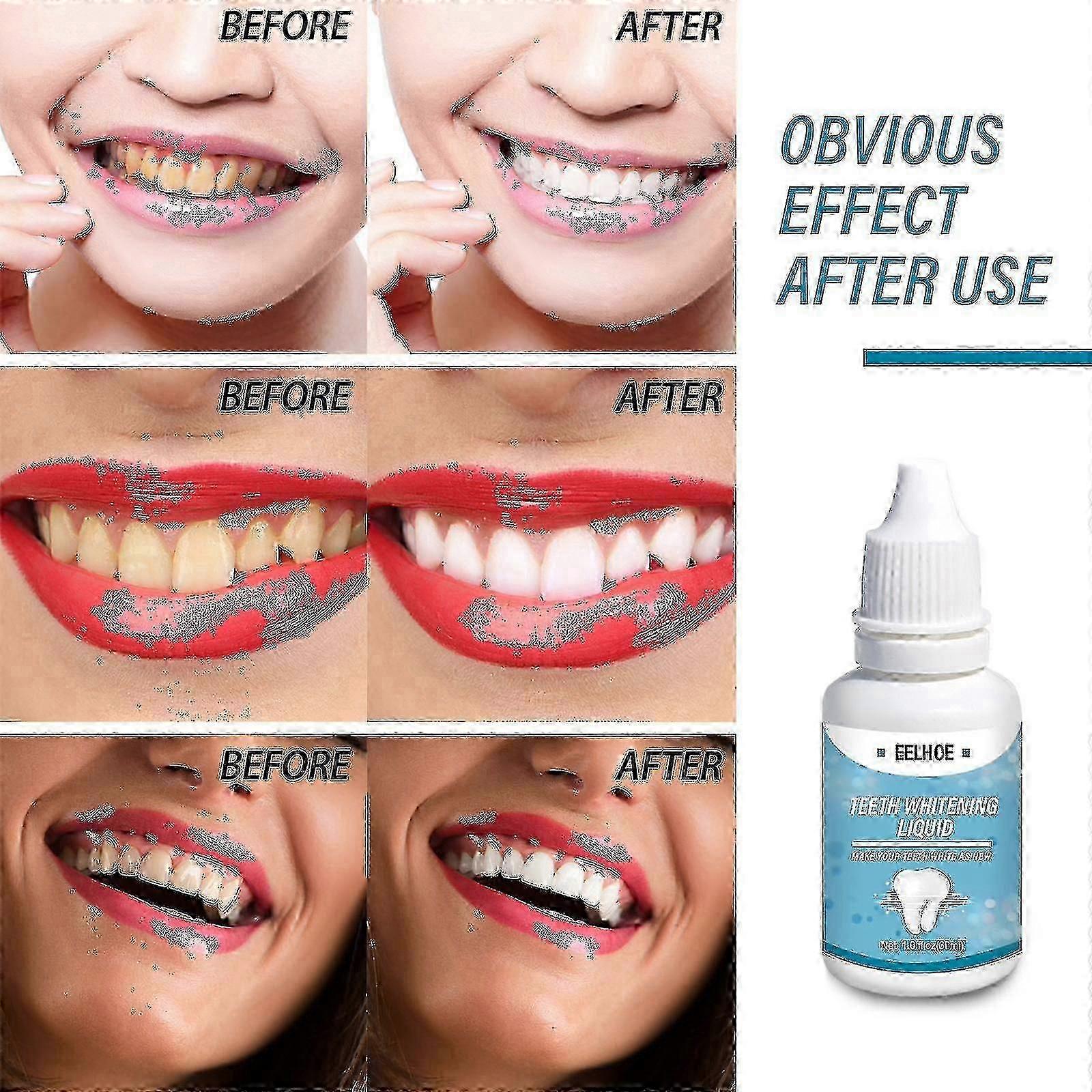 Eelhoe歯のホワイトニング液体の歯の黒い歯の煙の歯の新鮮な息の明るさ-4326418855213