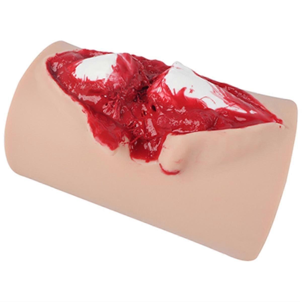 Tibia Open Fracture Training Module Wearable Open Fracture Wound Simulation Suture Training Model