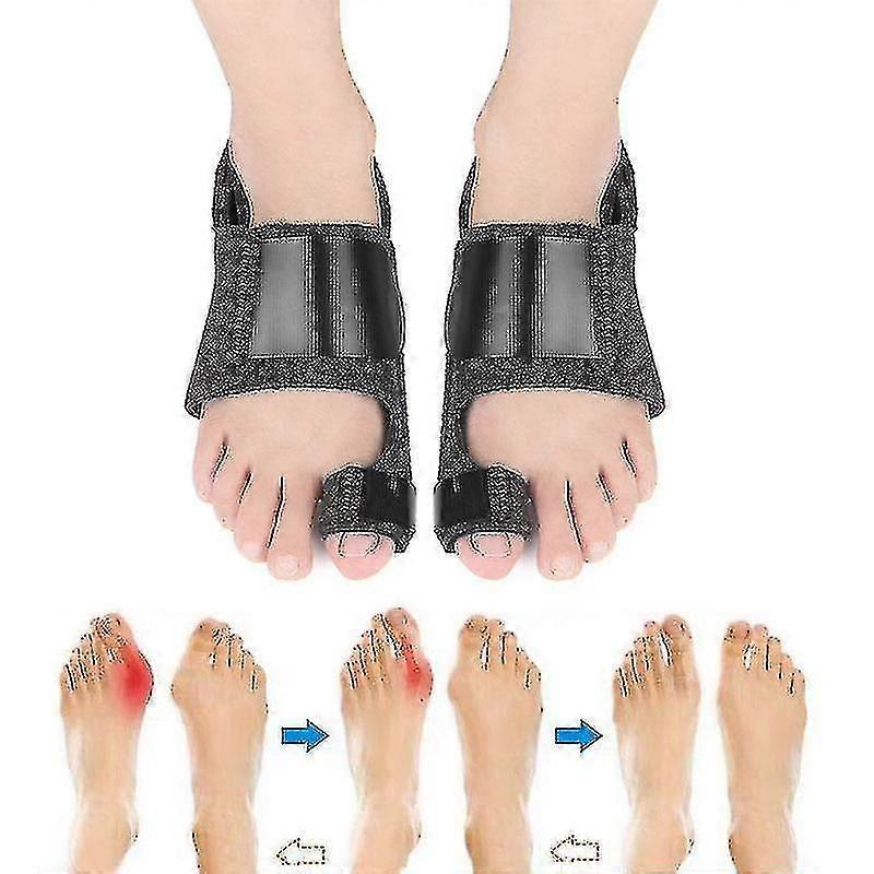 Pair Toe Separator Hallux Valgus Bunion Correction Belt|foot Care Tool