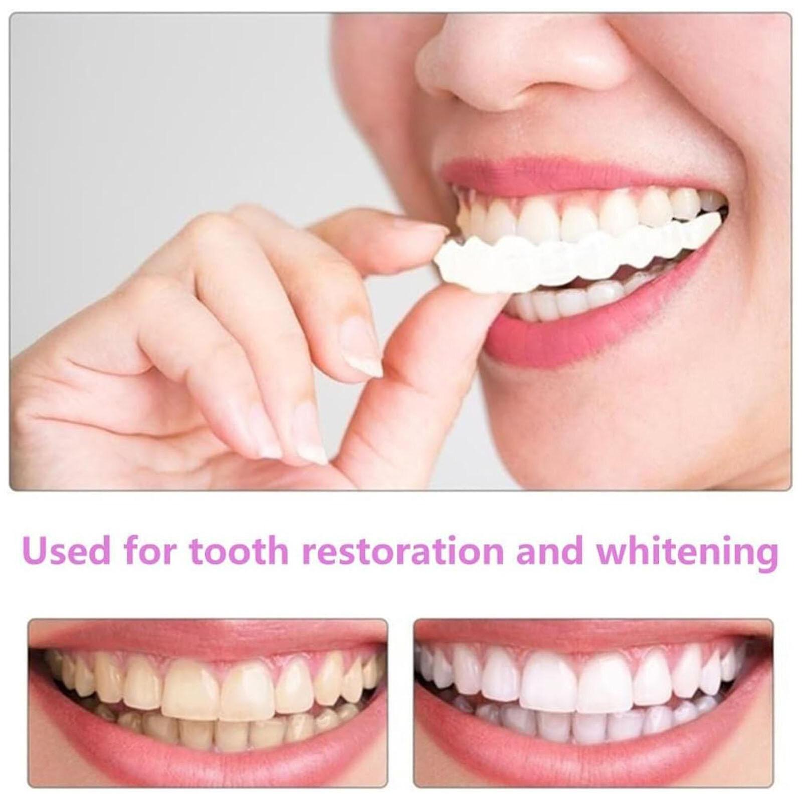 Snap On Upper&Bottom Teeth Set False Teeth Denture Veneers Dental Tooth Cover