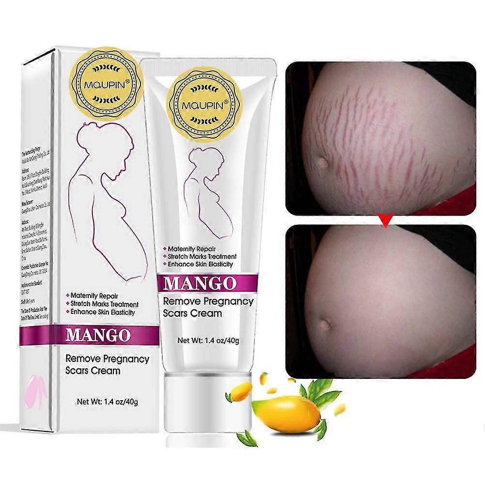 Mango stretch marks and scar cream -stretch marks and scar removal cream for pregnancy - best body moisturizer-40g