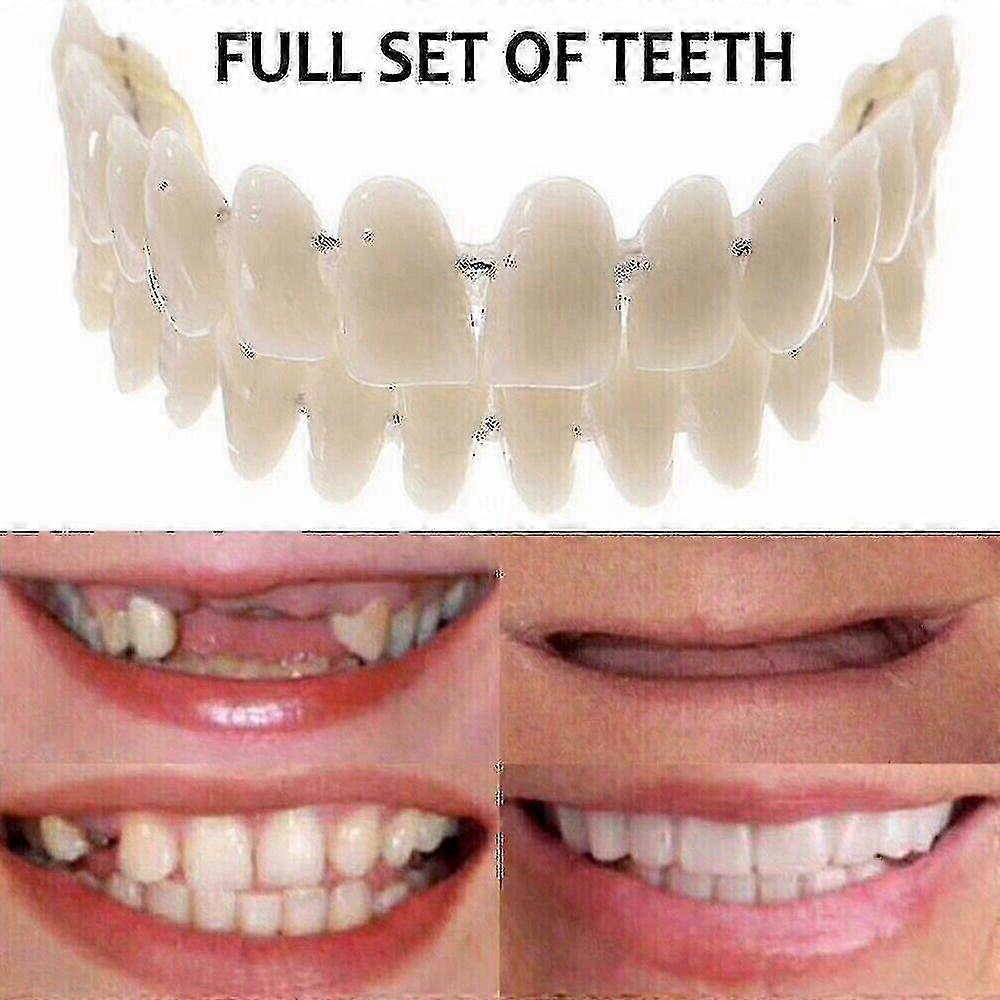 Smile Snap On False Teeth Upper Lower Dental Veneers Dentures Tooth Cover Set