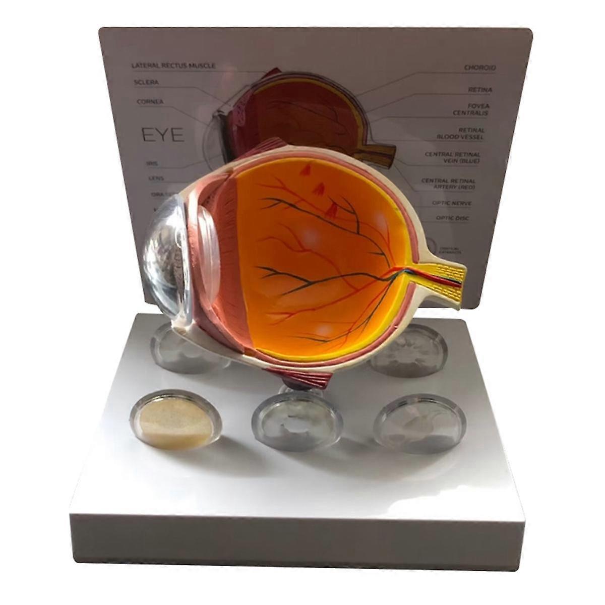 Eyeball Model Human Eye Demonstration Glaucoma Cataract Anatomy Medical Teaching Tool Eyeball Lesio
