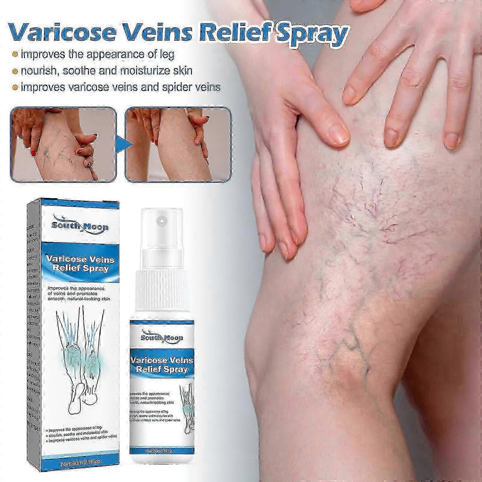 静脈マッサージスプレーレリーフミミズレッグマッサージ静脈瘤静脈瘤修復痛腫れボディケア質量