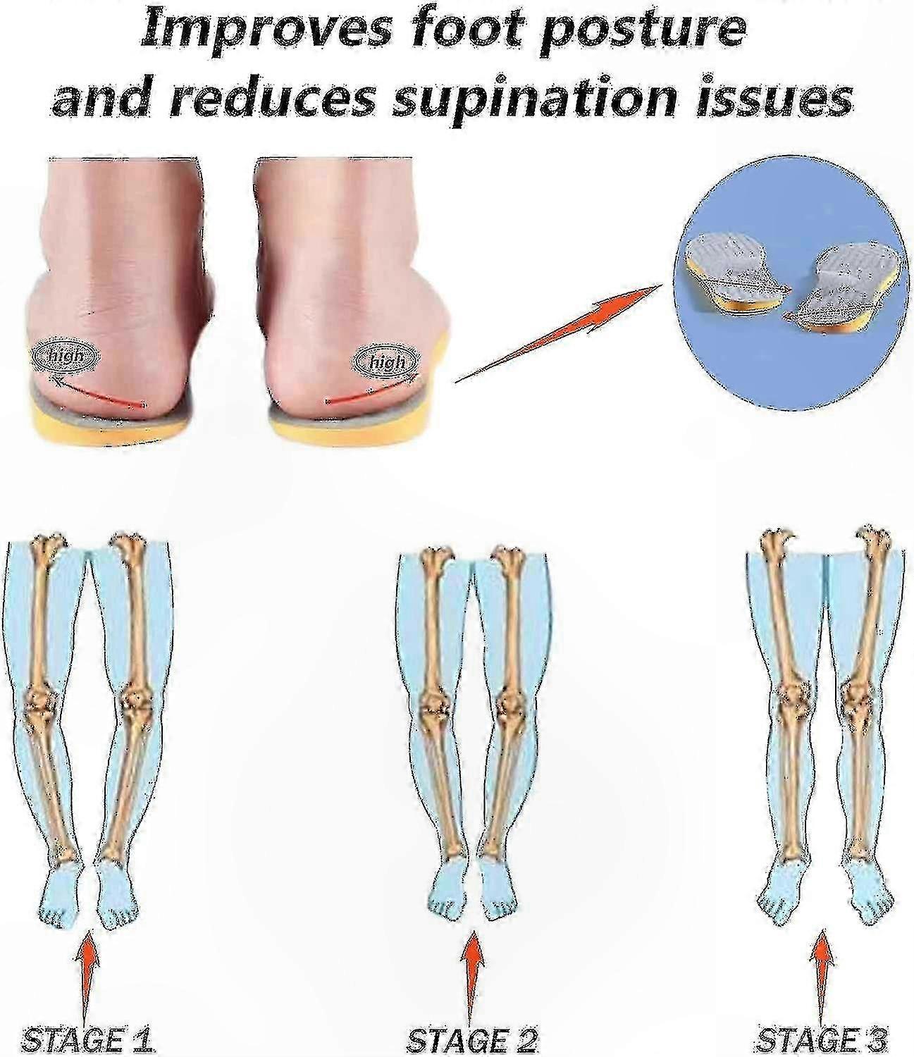 Arch Support Insoles for High Arches & Supination, Orthotic Inserts for Proper Foot Alignment and Stability