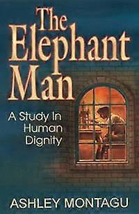 El hombre Elefante